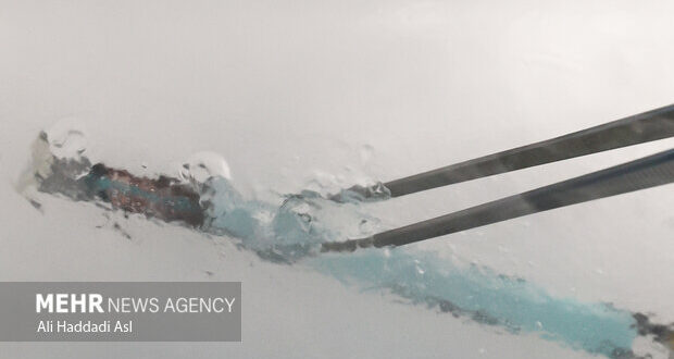 فریز جنین چیست و برای چه کسانی توصیه می‌شود؟