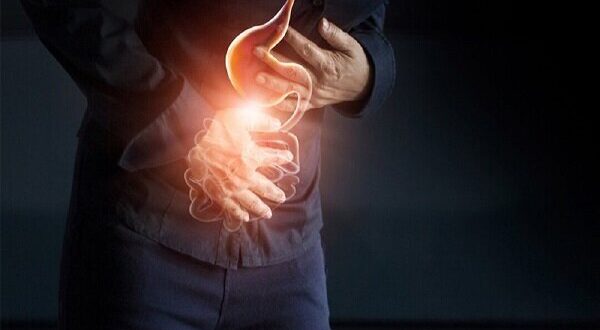 مدیریت رفلاکس در ماه رمضان؛ افطار سبک، معده سالم