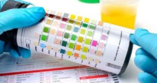 جواب آزمایش داری؟ بفرست بله