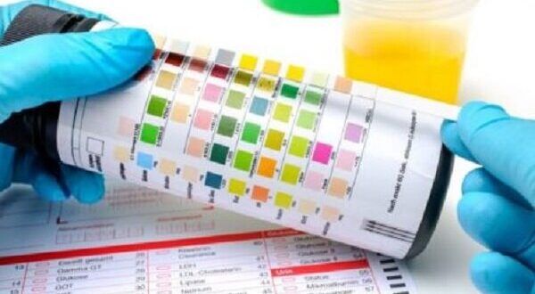 جواب آزمایش داری؟ بفرست بله